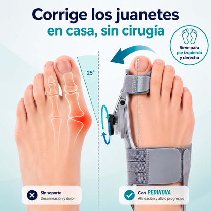 PediNova Align™ | Corrector Ajustable para Juanetes